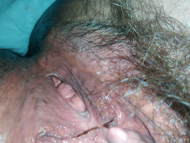 Vagina close-up full of hair